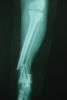 post-135-1278663955_thumb.jpg